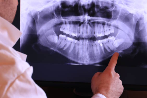 Best Emergency Tooth Extraction in Ridgely, TN